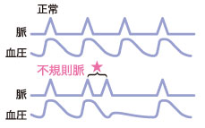 【鬼】手首式血圧計 UB-522の特徴！