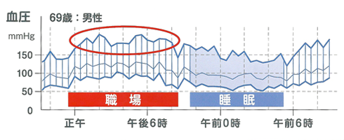 職場高血圧 画像